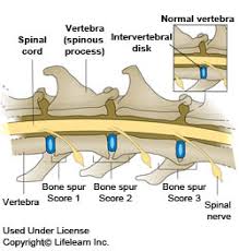 The wall chart shows the skeletal structure of the cat. Spondylosis Deformans In Cats Vca Animal Hospital