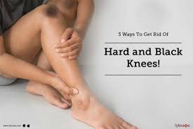 Why are my knees so dark? 3 Ways To Get Rid Of Hard And Black Knees By Dr Dhananjay Chavan Lybrate