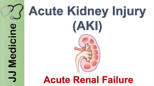 Семидоцька жана дмитрівна — професор кафедри. Acute Kidney Injury Aki Acute Renal Failure Diagnosis Causes And Treatment Youtube