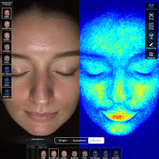 Meicet analisador de testador uv mc88, equipamento de teste, analisador de  tipo de pele de skincope, máquina mágica de teste de espelho| Alibaba.com