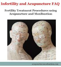 Fertility Acupuncture And Reproductive Health Acupuncture Moxibustion Infertility