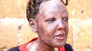 Murimi anorima zvipfuyo parutivi penzira ne murume anoroora mukadzi  anopinda mubhawa dambudziko ravo rimwe chete