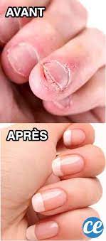 6 Astuces Qui Marchent Pour Ne Plus Jamais Vous Ronger Les Ongles