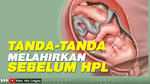 Cara alami percepat pembukaan saat bersalin. Hpl Sudah Dekat Inilah Tanda Tanda Akan Melahirkan Youtube
