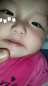 Le salio un diente @soyjohnsonjr @@lashaparrita-gt_💟💋💝🌛💯🥏