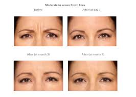 Find inspiration for home décor, furniture, home organization, cleaning hacks and more! Botox And Fillers Fab Med Spa And Cosmetic Laser Center