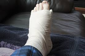 Image result for Foot Fracture