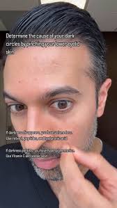 Image result for Eye Acidity Test