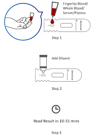 Uw medicine department of laboratory medicine & pathology testing sites. Covid 19 Antibody Rapid Test Kit Coronavirus Igm Igg Antibody Test