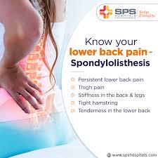 Spondylolisthesis In 2020 Spondylolisthesis Health Ads Healthcare Ads