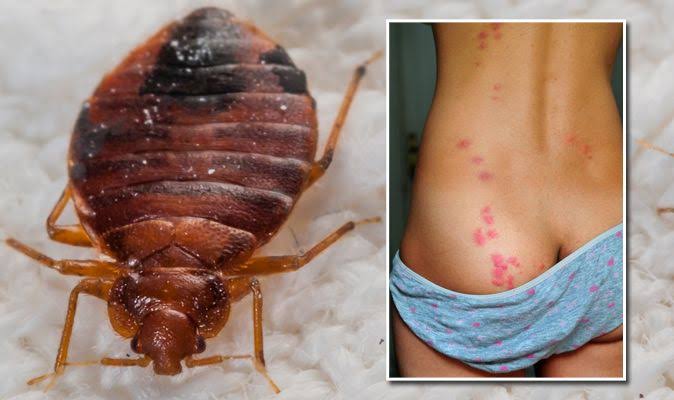 Image result for Signs of Bed Bugs"