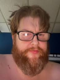 Fundraiser by Steve Nall : Support My Journey as a Double Amputee