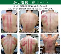 かっ さ 肩こり 自分 で