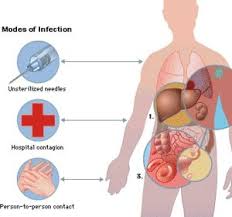 Don't delay your care at mayo clinic featured conditions ebola virus and marburg virus are difficult to diagnose because early signs and symptoms resemble those of other diseases, such as typhoid and malaria. Febbre Emorragica Di Marburg Trasmissione E Sintomi Scienza Salute