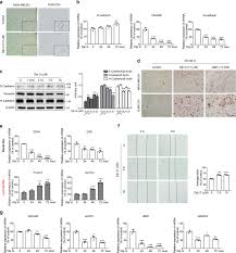 The american cancer society (acs) says that people who have taken birth control pills are slightly more likely to develop breast cancer than those researchers are not sure why birth control pills may lower the risk of certain cancers. Triggering A Switch From Basal To Luminal Like Breast Cancer Subtype By The Small Molecule Diptoindonesin G Via Induction Of Gabarapl1 Cell Death Disease