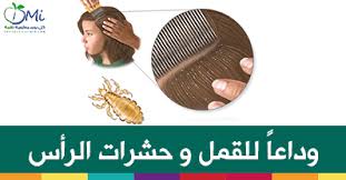 قل وداعا للقمل و حشرات الرأس مقالات طبية كل يوم معلومة طبية Healthy Life Healthy Life