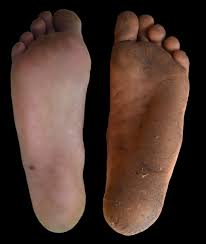 Does melinda gates have tattoos? Causes Of Smelly Feet And Their Treatment