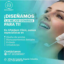 Maximo Rangel Gimenez (@gpaldent) • Instagram photos and videos