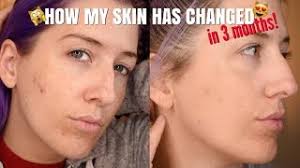 Start your skin transformation journey with jan marini skin care products! My Skincare Routine Jan Marini Skin Care Management System Review Youtube