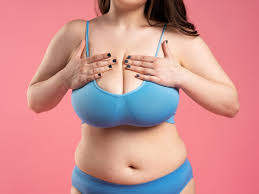 Cirurgia de redução de mamas: o que é e quando é indicada