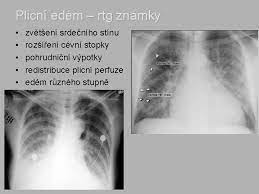 Maybe you would like to learn more about one of these? Klinick Anatomie Rtg Hrudnku Petr Ndenek 20089 Department