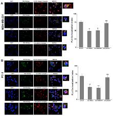 Install crdroid oreo rom on. Ijms Free Full Text Integrin Linked Kinase Links Integrin Activation To Invadopodia Function And Invasion Via The P T567 Ezrin Nherf1 Nhe1 Pathway Html