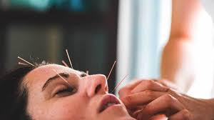 What Is Facial Acupuncture Skin Benefits Cost And Side