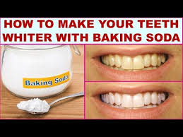 How To Whiten Teeth With Braces With Baking Soda Youtube