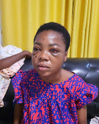 Ghanaian student shot in eye to undergo surgery in June