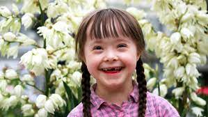 Downs Syndrome And Celiac Disease Gluten Free Rn