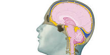 Image result for icd 10 code for idiopathic normal pressure hydrocephalus