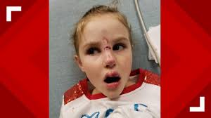 7-year-old Georgetown girl survives dog attack