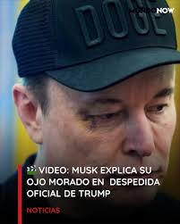 MUSK APARECIÓ CON UN OJO MORADO DURANTE SU DESPEDIDA EN LA CASA BLANCA. 🎬  VIDEO >>> Su explicación: https://mundo.social/4402Zja