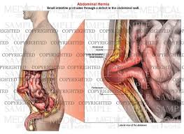The muscle is crossed by three fibrous bands called the. Male Abdomen Anatomy Anatomy Drawing Diagram
