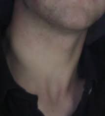 The anterior and posterior triangles. Neck Wikipedia