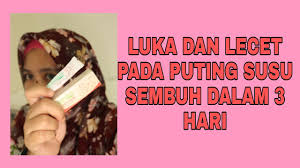 Ayu yang berumur 22 tahun hanya mengenakan seluar dalam memastikan pintu biliknya dikunci sebelum memperagakan body untuk tatapan dirinya. Payu Dara Putih Akibat Gigitan Anak Berita 2021