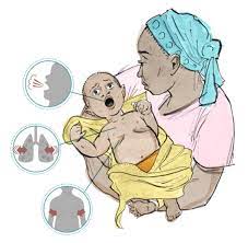 For viral infected pneumonia, the symptoms take time to show up. Pneumonia Resources For Caregivers And Health Workers
