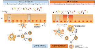 Frontiers The Gut Microbiota In The Pathogenesis And Therapeutics Of Inflammatory Bowel Disease Microbiology