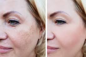 Kaya White Lumenis Brightening Day Cream Review