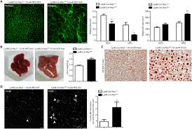 Maybe you would like to learn more about one of these? Fig 2 Neuropilin 1 Expression In Adipose Tissue Macrophages Protects Against Obesity And Metabolic Syndrome Science Immunology