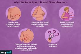 However, it may often start earlier or later. Breast Fibroadenomas Symptoms Diagnosis Treatment