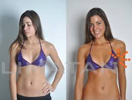 El bronceado dha caña de azucar es un producto 100% natural, el cual no está contraindicado para ningun tipo de piel, y que permite obtener un bronceado muy natural e inmediato sin riesgos para la piel, sano y sin manchas. Limatan Bronceado En Spray La Manera Mas Rapida Y Saludable De Lucir Un Bronceado Una Sola Sesion Menor A 10min Natural En Base A Cana De Azucar Cubre Imperfecciones Diferentes Intensidades