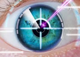 Laser Vs Traditional Cataract Surgery In 2020 Nvision Eye Centers