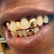 A.534 sw 3rd ave suite 707. The Plug Jewelry Gold Teeth Grillz 135 Photos Jewelry 12592 San Pablo Ave Richmond Ca Phone Number Yelp