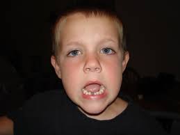 First lost tooth (koko's corner)