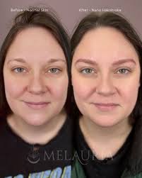 This memoriam piece was a sentimental one for me. Candy is my best friends  Mom and I consider their family a second family to me. Last year, we sadly  lost Richard, Candy's