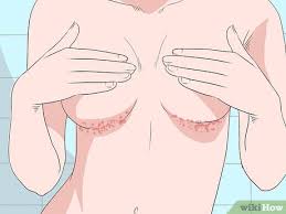 Image result for heat rash under breasts