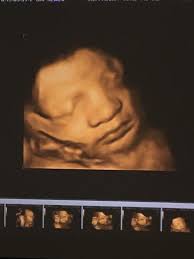 3D Baby Fetal Imagery
