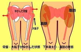 大転子の出っ張りを引っ込める 大転子矯正ストレッチ 大転子 矯正 大転子 骨盤矯正 ストレッチ