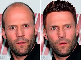 Who is jason statham dating? Bald Celebs With Hair Album On Imgur